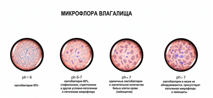 Что означают лейкоциты в мазке на микрофлору