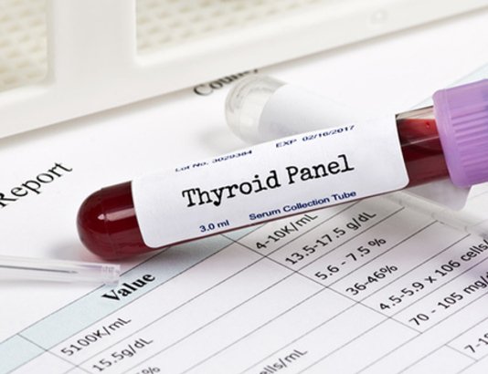 Что такое тиреотропный гормон (ТТГ)? Что означает высокий и низкий ТТГ?