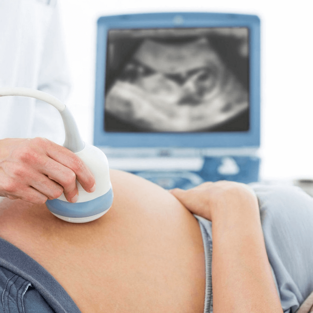 УЗИ при беременности в Балашихе